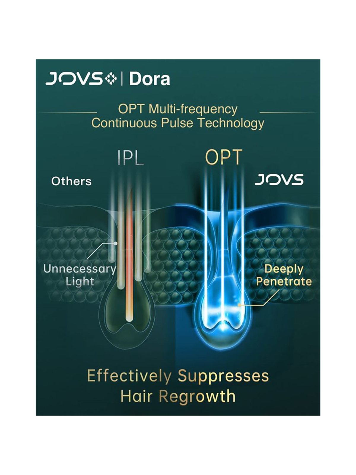 JOVS Dora Laser Hair Removal, IPL Permanent Painless Hair Removal Device