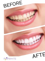 2-in-1 Teeth Whitener + Toothpaste