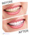 2-in-1 Teeth Whitener + Toothpaste