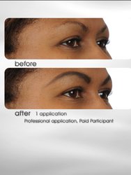 Brow Extension