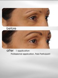 Brow Extension